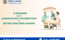 Laparoscopic Hysterectomy